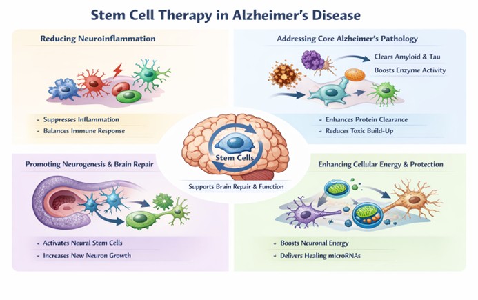 Figure A : Stem cells may reduce inflammation, clear toxic proteins, stimulate neuron growth, and enhance energy function to support brain repair in Alzheimer’s disease.
