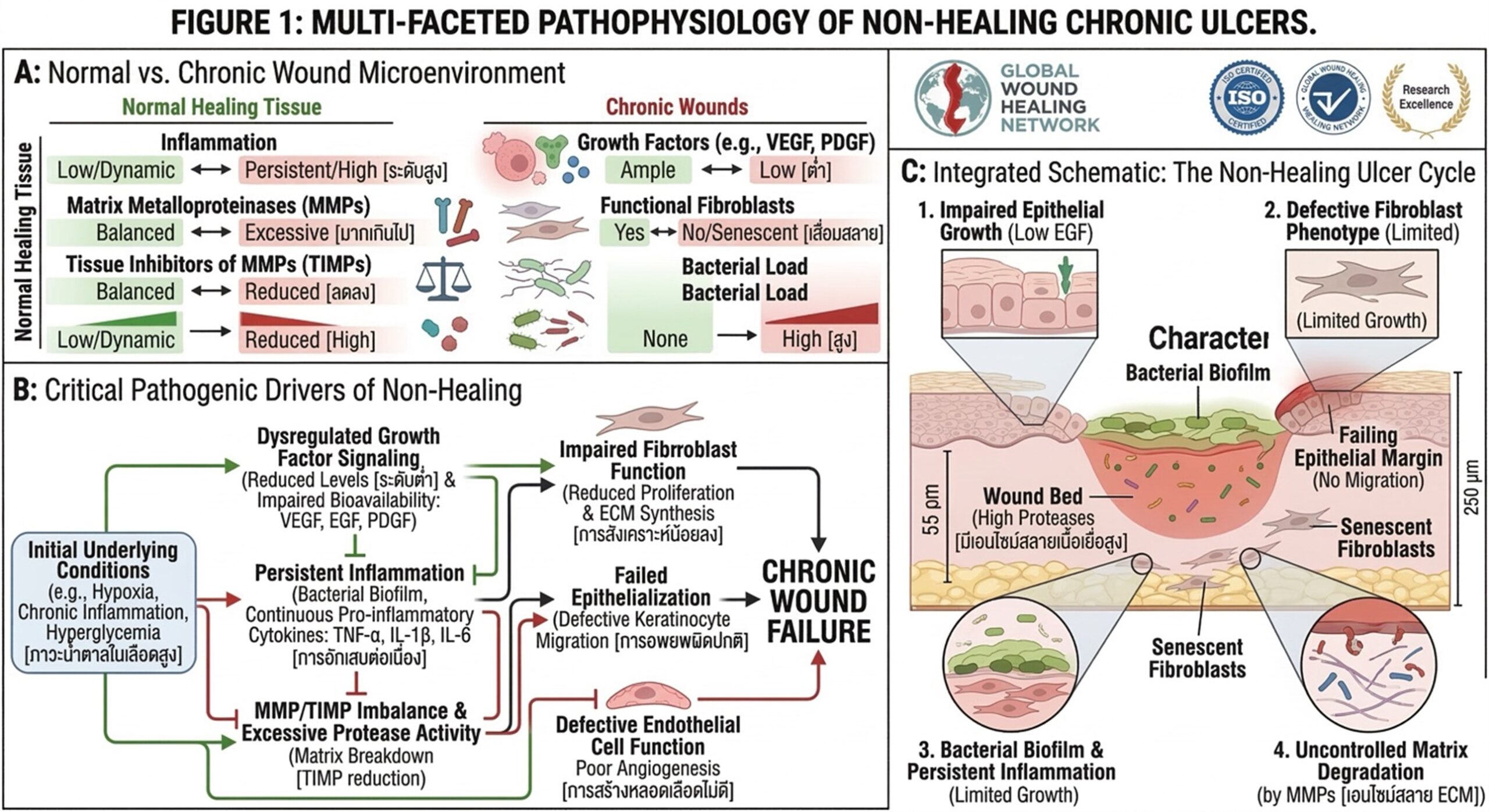 Figure 1: Pathophysiological mechanisms of non-healing chronic ulcers.