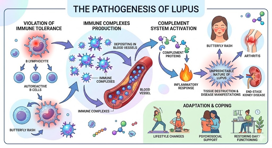 Figure 1: The pathogenesis of Lupus