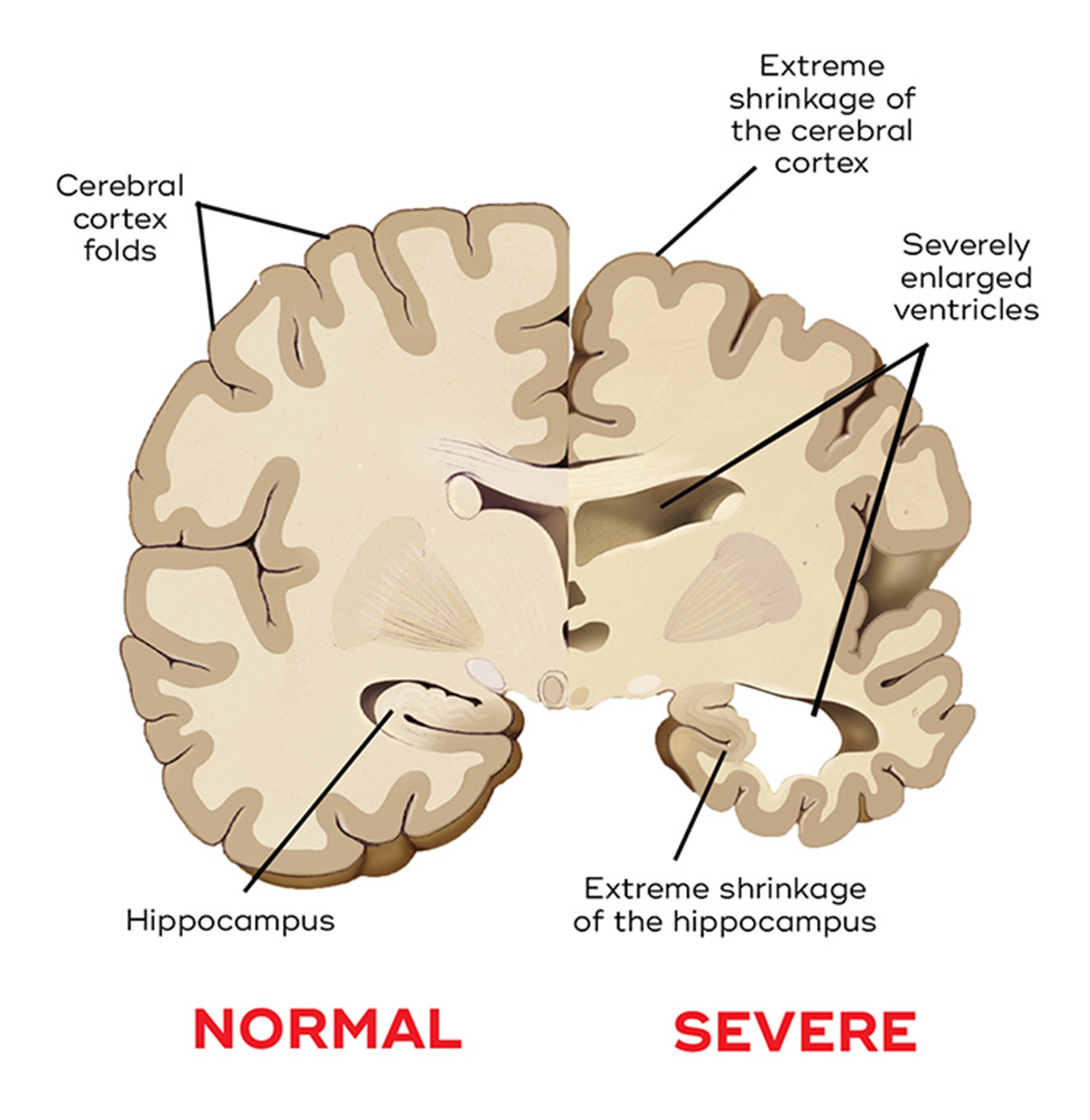 Figure 1: Mechanisms of Dementia and Regenerative Support