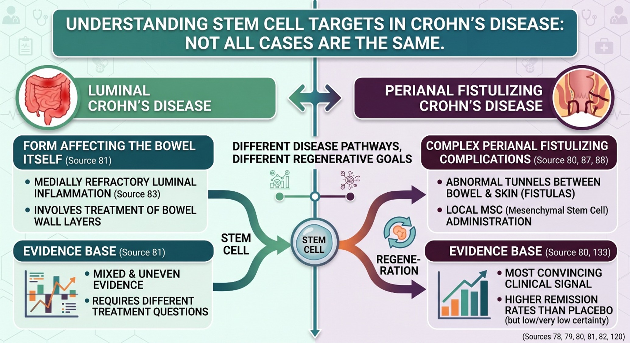 Where stem cells fit in Crohn’s disease today