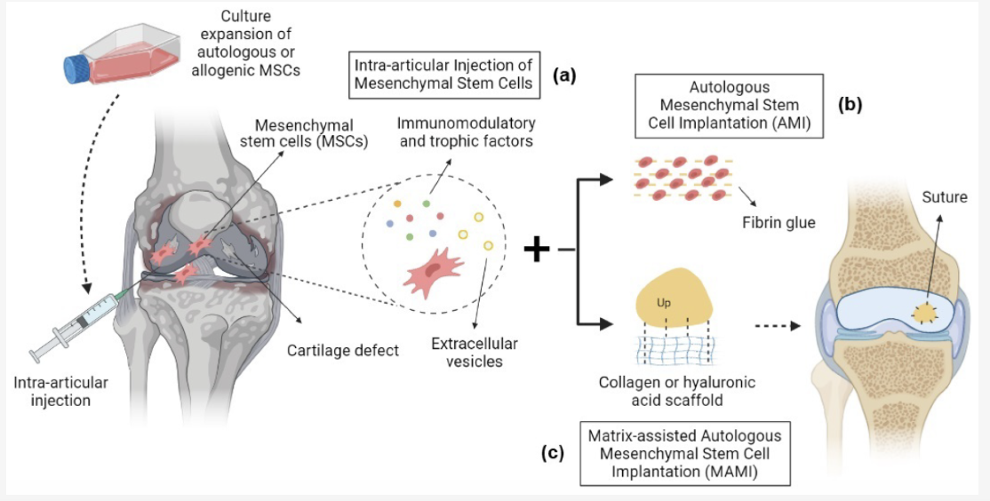 Figure A: How stem cell therapy repairs joints by growing cartilage, improving the healing of tissue in an injured joint, pain relief and slowing or reversing the degenerative process of a joint and the similarities between using umbilical cord-derived stem cells for transplantation and other advantages.