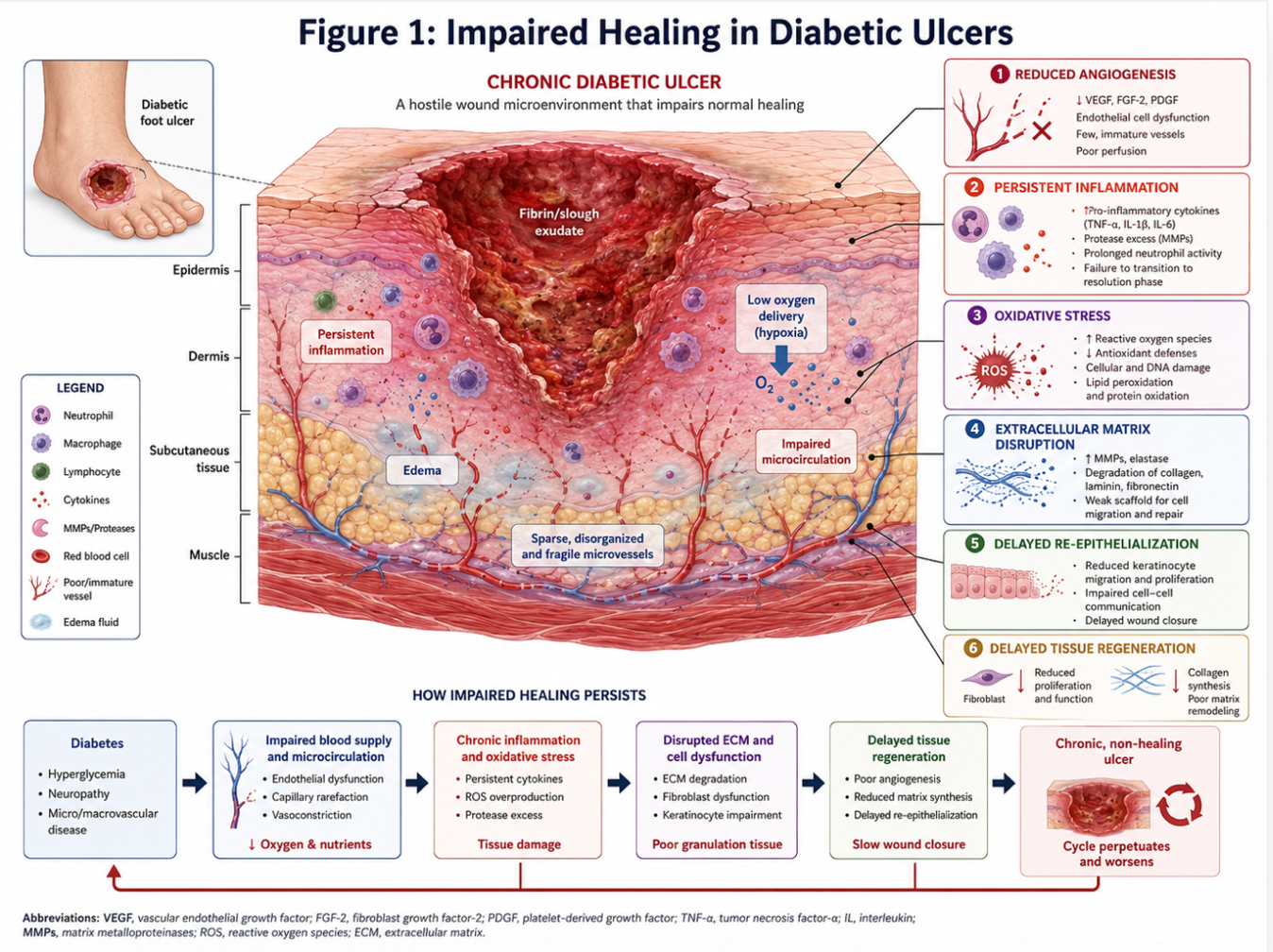 Figure 1: Impaired Healing in Diabetic Ulcers Illustration of impaired healing in diabetic ulcers, highlighting reduced angiogenesis, persistent inflammation, and delayed tissue regeneration.